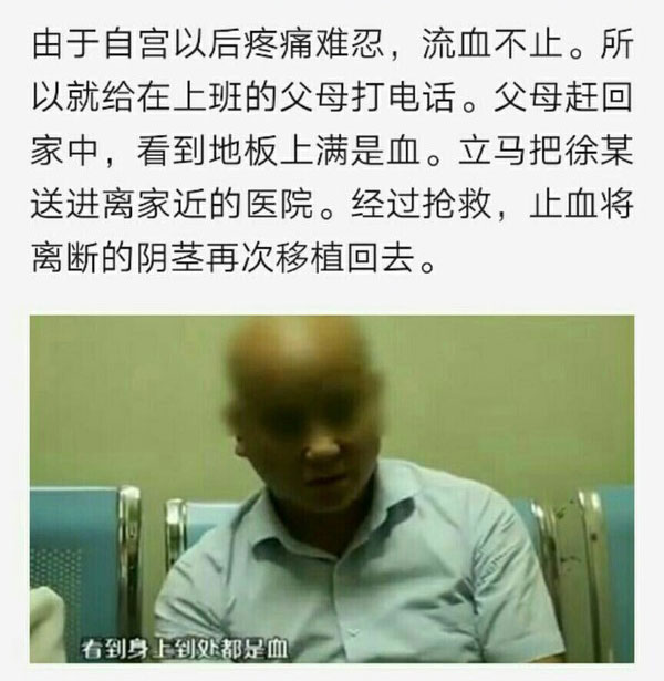 又是自残游戏？16岁少年家中自宫，医生惊呼：这，连根切断！