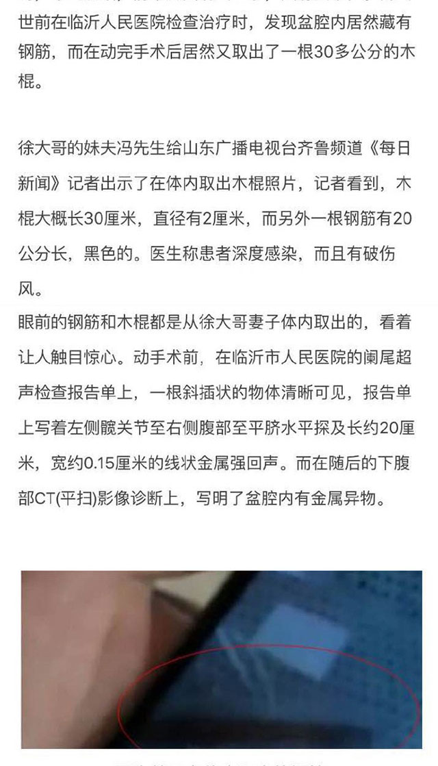 在山东，目前很有可能存在一个专门以虐待智障人士为乐的变态狂