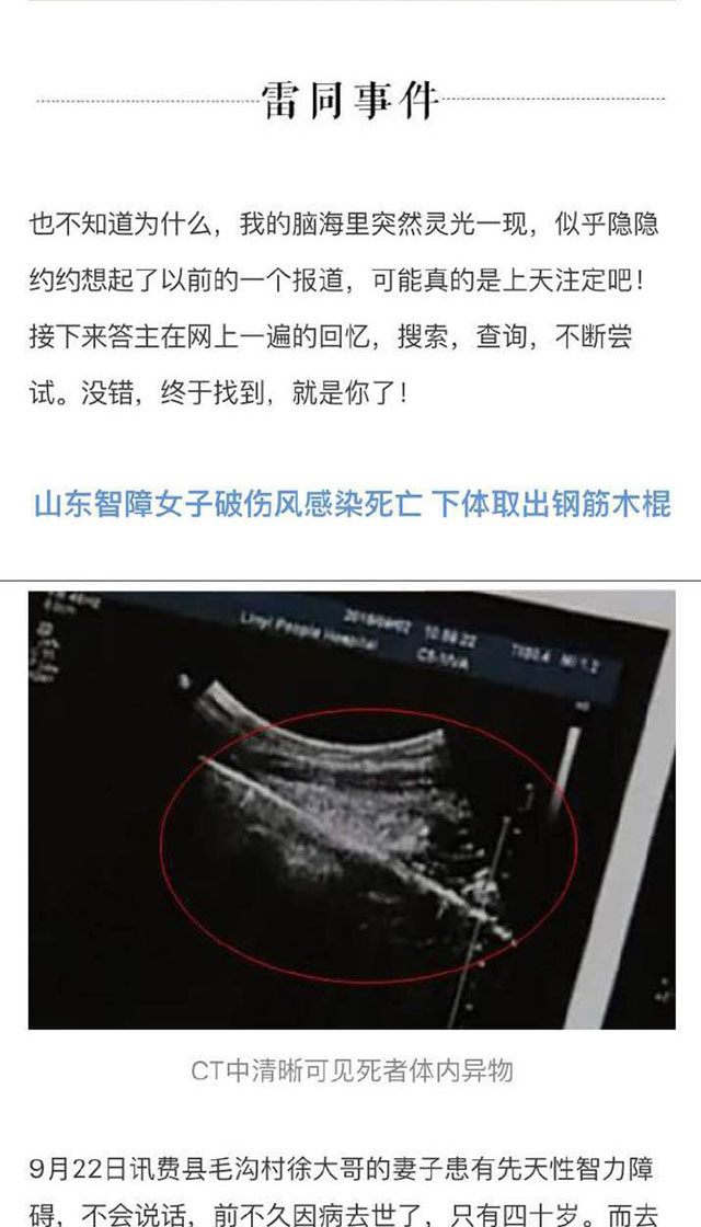 在山东，目前很有可能存在一个专门以虐待智障人士为乐的变态狂