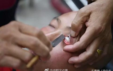 成都六旬老人用刀片给人洗眼睛 体验者都是胆大之人